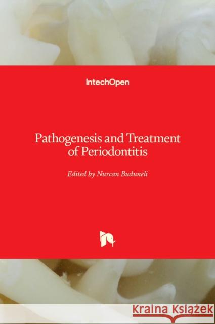 Pathogenesis and Treatment of Periodontitis Nurcan Buduneli 9789533079240 Intechopen - książka