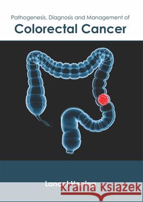 Pathogenesis, Diagnosis and Management of Colorectal Cancer Lancel Herring 9781632427489 Foster Academics - książka