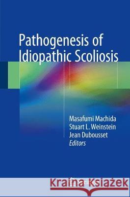 Pathogenesis of Idiopathic Scoliosis Masafumi Machida Stuart L. Weinstein Jean Dubousset 9784431565390 Springer - książka