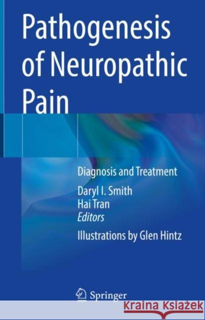 Pathogenesis of Neuropathic Pain: Diagnosis and Treatment Smith, Daryl I. 9783030914547 Springer International Publishing - książka