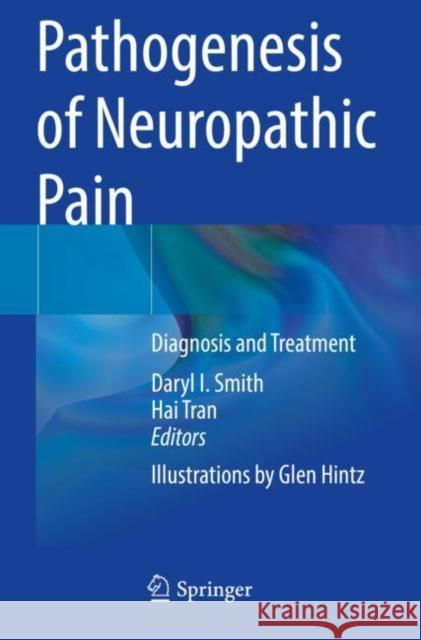 Pathogenesis of Neuropathic Pain: Diagnosis and Treatment Daryl I. Smith Hai Tran 9783030914578 Springer - książka