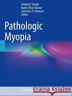 Pathologic Myopia  9783030743369 Springer International Publishing - książka