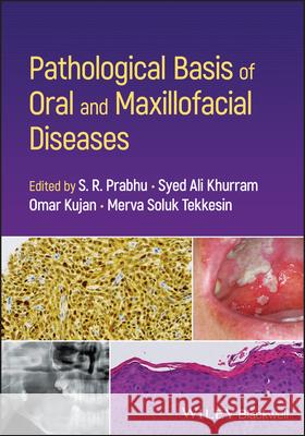 Pathological Basis of Oral and Maxillofacial Disea ses  9781119989202  - książka