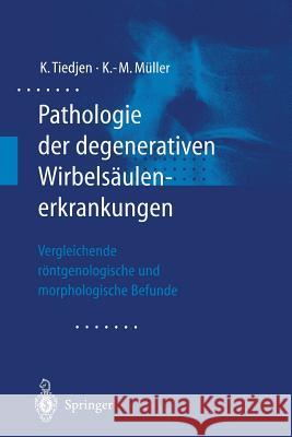 Pathologie Der Degenerativen Wirbelsäulenerkrankungen: Vergleichende Röntgenologische Und Morphologische Befunde Tiedjen, Kay 9783540677741 Springer - książka