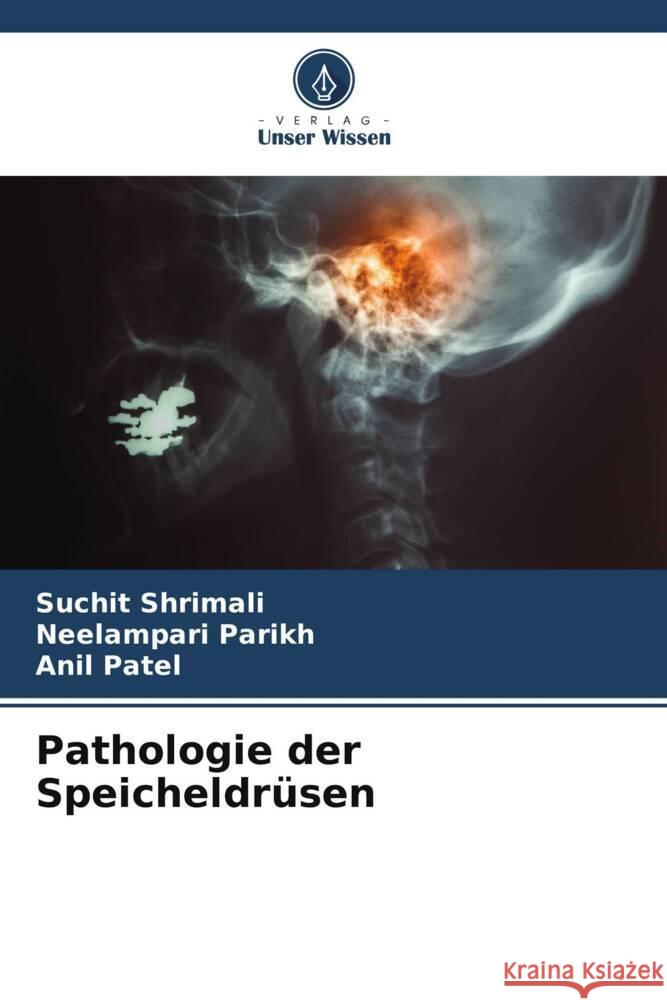 Pathologie der Speicheldrüsen Shrimali, Suchit, Parikh, Neelampari, Patel, Anil 9786205460924 Verlag Unser Wissen - książka