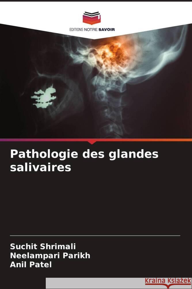 Pathologie des glandes salivaires Shrimali, Suchit, Parikh, Neelampari, Patel, Anil 9786205460894 Editions Notre Savoir - książka