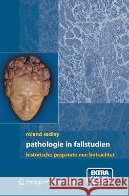 Pathologie in Fallstudien: Historische Präparate Neu Betrachtet Sedivy, Roland 9783211306963 Springer, Wien - książka