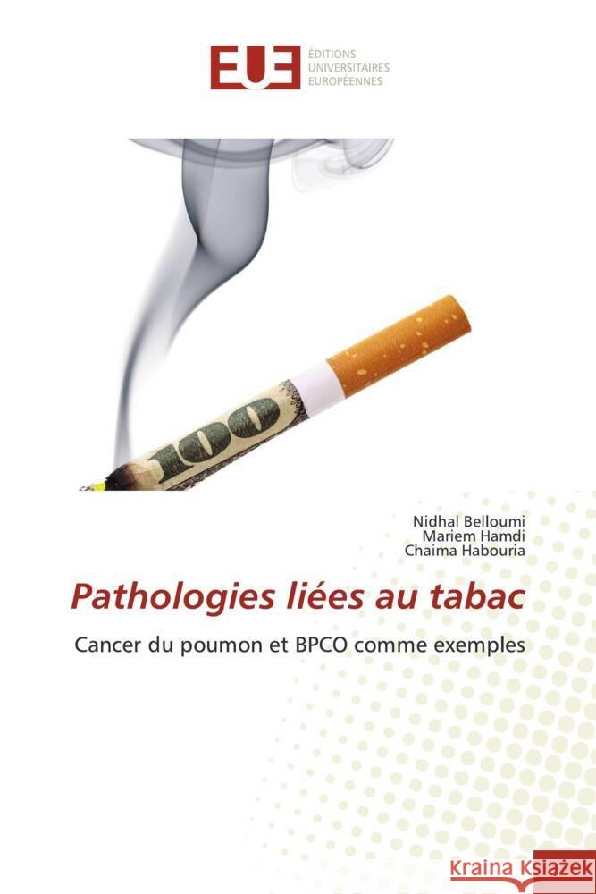 Pathologies liées au tabac Belloumi, Nidhal, Hamdi, Mariem, Habouria, Chaima 9786203439670 Éditions universitaires européennes - książka