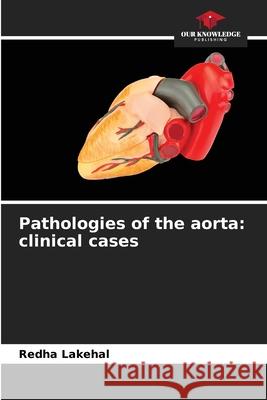 Pathologies of the aorta: clinical cases Redha Lakehal 9786205260883 Our Knowledge Publishing - książka