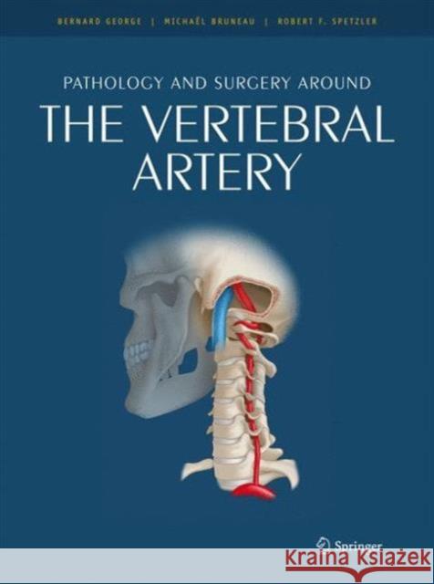 Pathology and Surgery Around the Vertebral Artery George, Bernard 9782287897863 Springer - książka