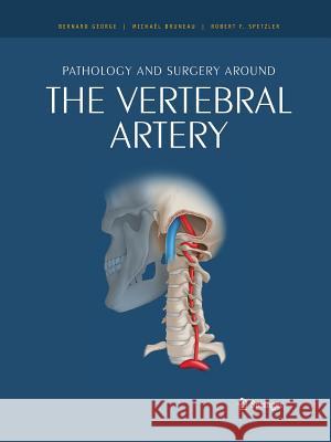 Pathology and Surgery Around the Vertebral Artery George, Bernard 9782817805177 Springer - książka