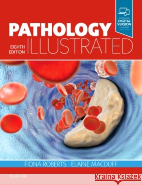 Pathology Illustrated Roberts, Fiona 9780702072062 Elsevier Health Sciences - książka