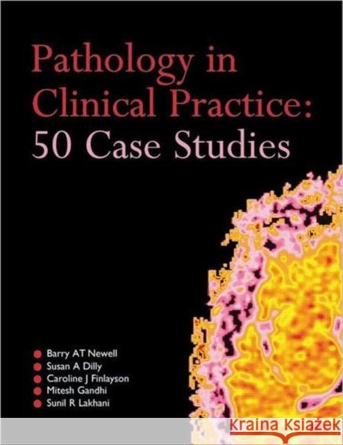 Pathology in Clinical Practice: 50 Case Studies Barry Newell 9780340959046  - książka
