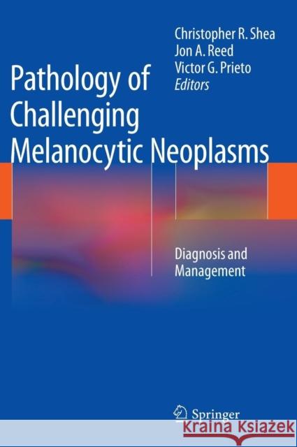 Pathology of Challenging Melanocytic Neoplasms: Diagnosis and Management Shea, Christopher R. 9781493914432 Springer - książka