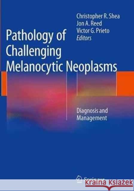 Pathology of Challenging Melanocytic Neoplasms: Diagnosis and Management Shea, Christopher R. 9781493941681 Springer - książka