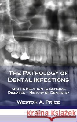 Pathology of Dental Infections: and Its Relation to General Diseases - History of Dentistry Weston a Price 9781789873672 Pantianos Classics - książka