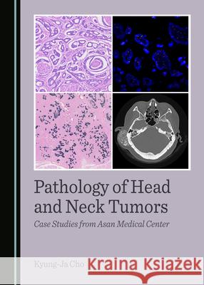 Pathology of Head and Neck Tumors: Case Studies from Asan Medical Center Kyung-Ja Cho 9781036407353 Cambridge Scholars Publishing - książka