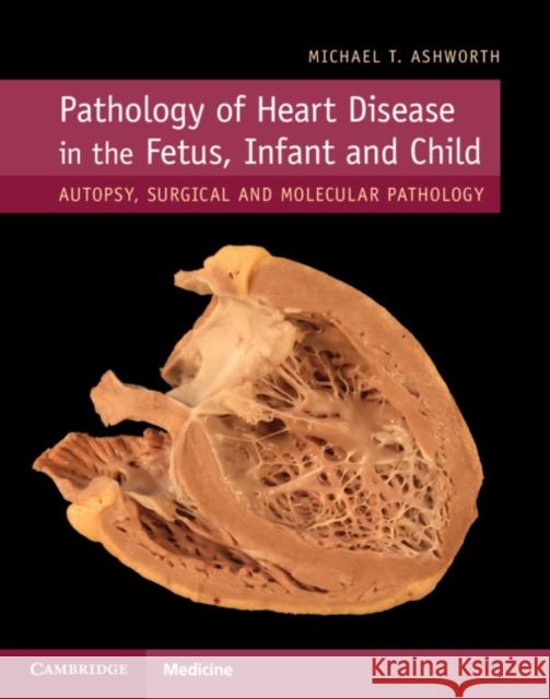 Pathology of Heart Disease in the Fetus, Infant and Child: Autopsy, Surgical and Molecular Pathology Michael T. Ashworth 9781107116283 Cambridge University Press - książka