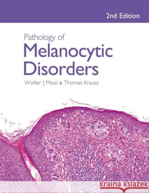 Pathology of Melanocytic Disorders 2ed Walter Mooi 9780340809686  - książka