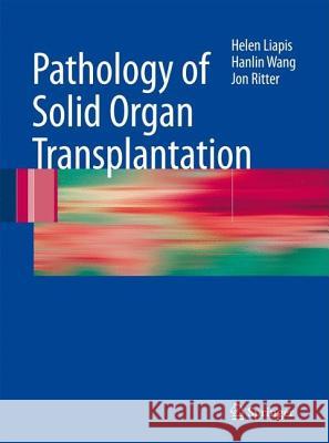 Pathology of Solid Organ Transplantation Helen Liapis Hanlin Wang Jon H. Ritter 9783540793427 Springer - książka