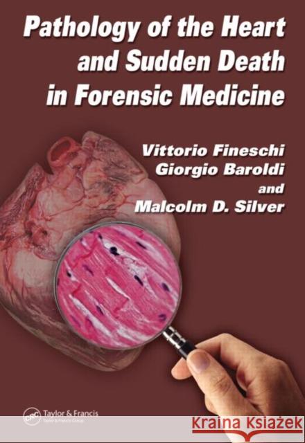 Pathology of the Heart and Sudden Death in Forensic Medicine Vittorio Fineschi Giorgio Baroldi Malcolm D. Silver 9780849370489 CRC Press - książka