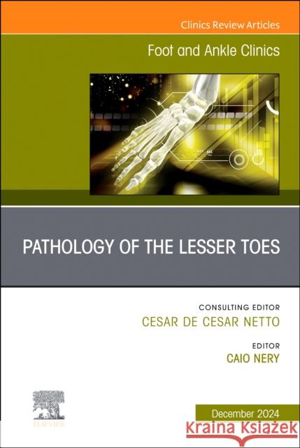 Pathology of the Lesser Toes, An issue of Foot and Ankle Clinics of North America  9780443129117 Elsevier - książka