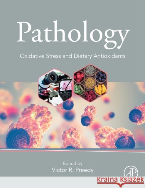 Pathology: Oxidative Stress and Dietary Antioxidants Victor R. Preedy 9780128159729 Academic Press - książka