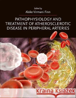 Pathophysiology and Treatment of Atherosclerotic Disease in Peripheral Arteries Aloke Virmani Finn 9780443135934 Elsevier - książka