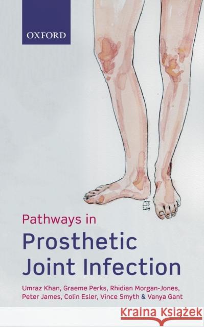 Pathways in Prosthetic Joint Infection Umraz Khan Graeme Perks Rhidian Morgan-Jones 9780198791881 Oxford University Press, USA - książka