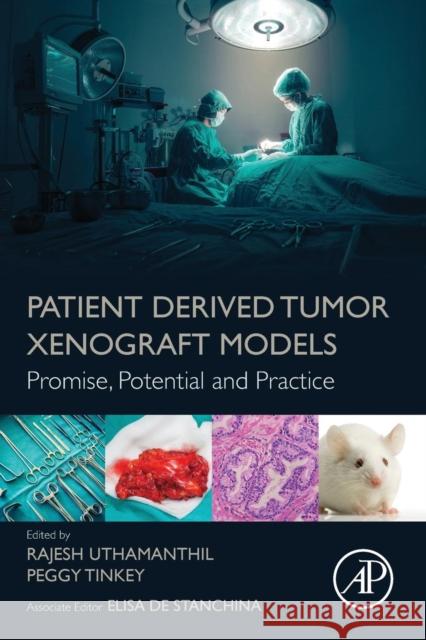 Patient Derived Tumor Xenograft Models: Promise, Potential and Practice Uthamanthil, Rajesh K. 9780128040102 Academic Press - książka