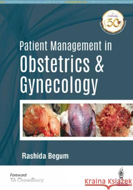 Patient Management in Obstetrics & Gynecology Rashida Begum 9789352705382 Jp Medical Ltd - książka