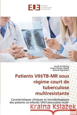 Patients VIH/TB-MR sous régime court de tuberculose multiresistante Marius, Irie Bi Irie 9786138476894 Éditions universitaires européennes - książka
