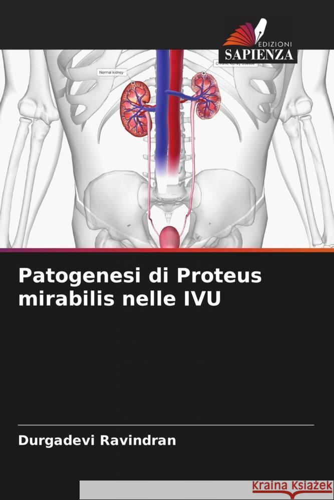 Patogenesi di Proteus mirabilis nelle IVU Ravindran, Durgadevi 9786206536260 Edizioni Sapienza - książka