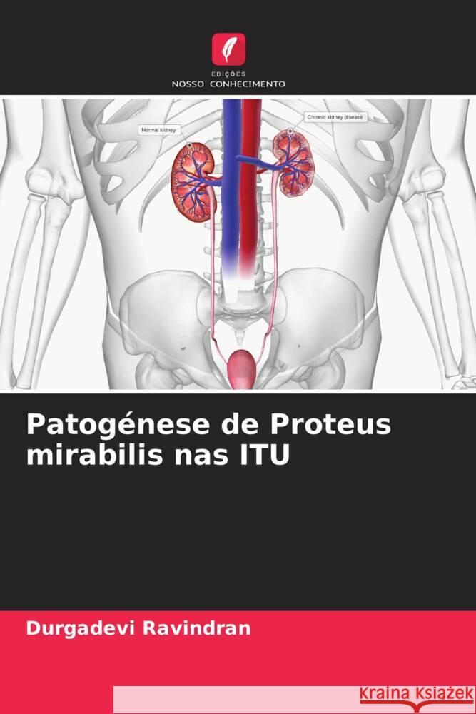 Patogénese de Proteus mirabilis nas ITU Ravindran, Durgadevi 9786206536277 Edições Nosso Conhecimento - książka