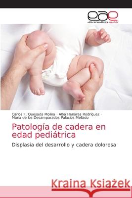 Patología de cadera en edad pediátrica Quesada Molina, Carlos F. 9786203037913 Editorial Academica Espanola - książka