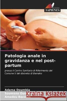 Patologia anale in gravidanza e nel post-partum Adama Doumbia Soumana Oumar Traore Amadou Bocoum 9786205814598 Edizioni Sapienza - książka