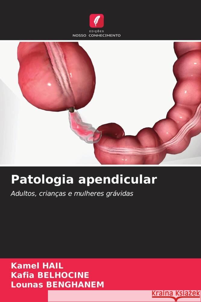 Patologia apendicular Kamel Hail Kafia Belhocine Lounas Benghanem 9786207181841 Edicoes Nosso Conhecimento - książka