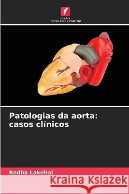 Patologias da aorta: casos clínicos Redha Lakehal 9786205260913 Edicoes Nosso Conhecimento - książka