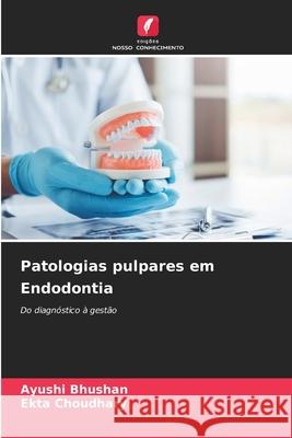 Patologias pulpares em Endodontia Ayushi Bhushan Ekta Choudhary 9786209236983 Edicoes Nosso Conhecimento - książka