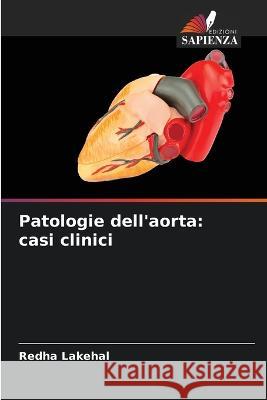 Patologie dell'aorta: casi clinici Redha Lakehal 9786205260906 Edizioni Sapienza - książka