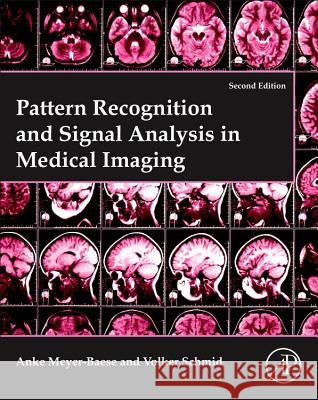 Pattern Recognition and Signal Analysis in Medical Imaging Anke Meyer-Baese Volker J. Schmid 9780128101162 Academic Press - książka