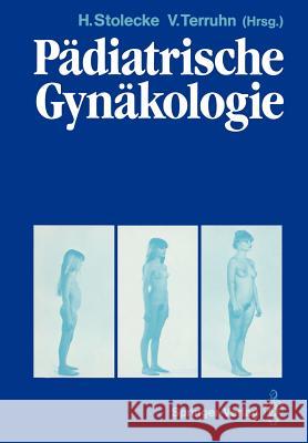 Pädiatrische Gynäkologie Essermittag, J. 9783642726637 Springer - książka