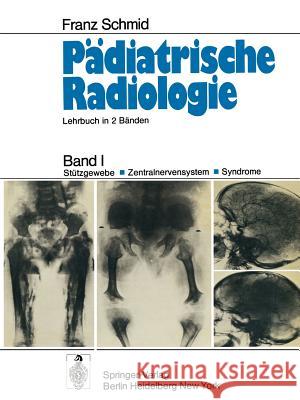 Pädiatrische Radiologie: Band I Stützgewebe - Zentralnervensystem #X00b7; Syndrome Schmid, Franz 9783642653971 Springer - książka