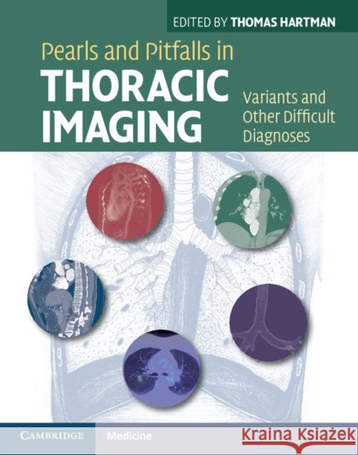 Pearls and Pitfalls in Thoracic Imaging: Variants and Other Difficult Diagnoses Hartman, Thomas 9780521119078  - książka