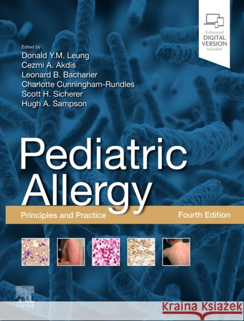 Pediatric Allergy: Principles and Practice: Principles and Practice Leung, Donald Y. M. 9780323674621 Elsevier - Health Sciences Division - książka