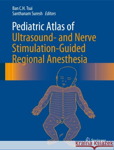Pediatric Atlas of Ultrasound- And Nerve Stimulation-Guided Regional Anesthesia Tsui, Ban C. H. 9780387799636  - książka
