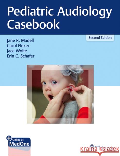 Pediatric Audiology Casebook Jane R. Madell Carol Flexer Jace Wolfe 9781626234031 Thieme Medical Publishers - książka