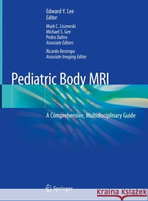 Pediatric Body MRI: A Comprehensive, Multidisciplinary Guide Lee, Edward Y. 9783030319885 Springer - książka