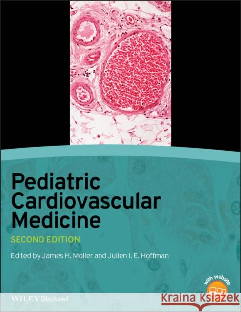 Pediatric Cardiovascular Medicine Julien I. E. Hoffman James H. Moller Julian I. E. Hoffman 9781444335897 Wiley-Blackwell - książka