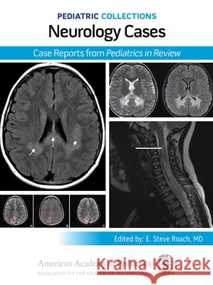 Pediatric Collections: Neurology Cases: Case Reports from Pediatrics in Review American Academy of Pediatrics (Aap) 9781610027731 American Academy of Pediatrics - książka